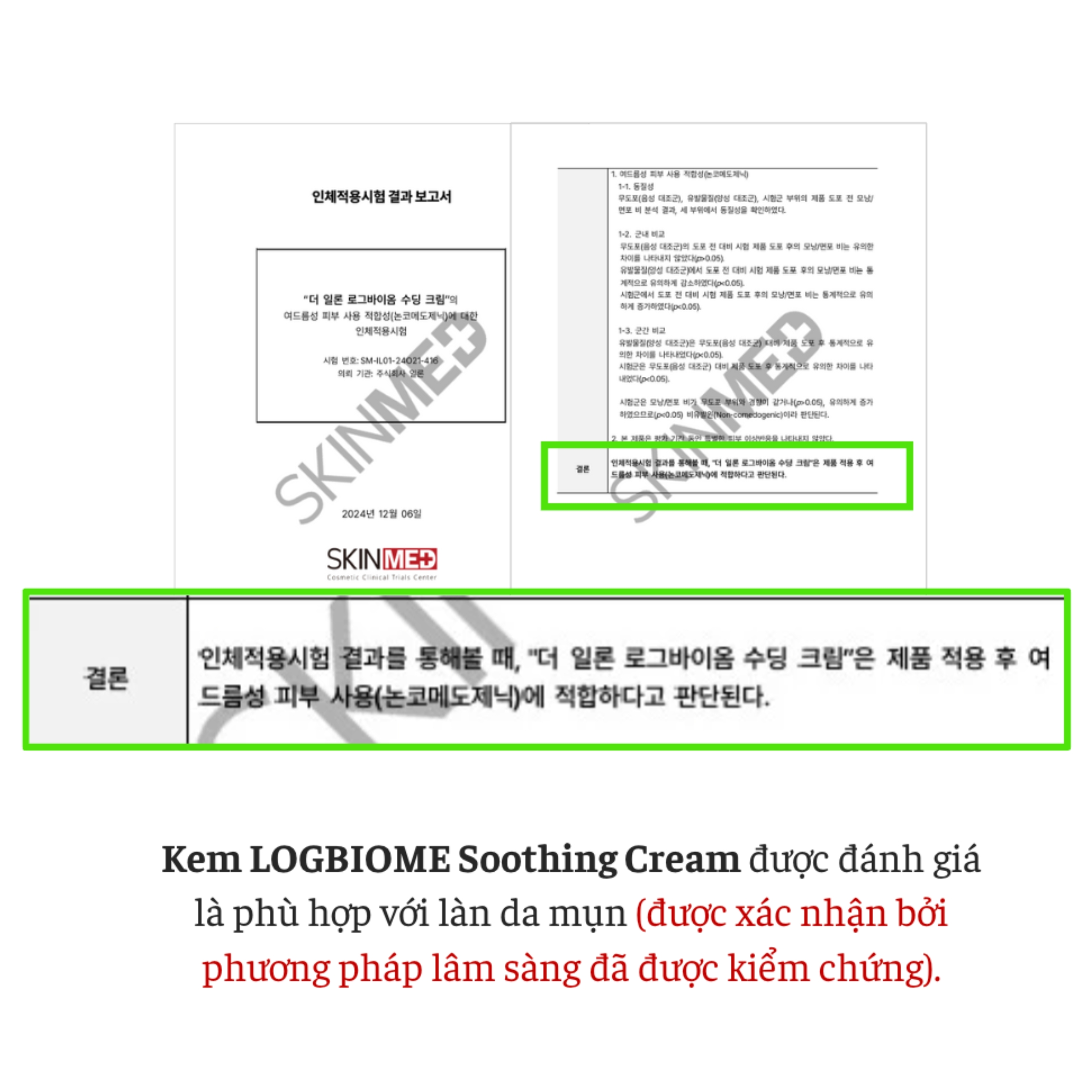 Kem Dưỡng Làm Dịu – The iLLon Logbiome Soothing Cream