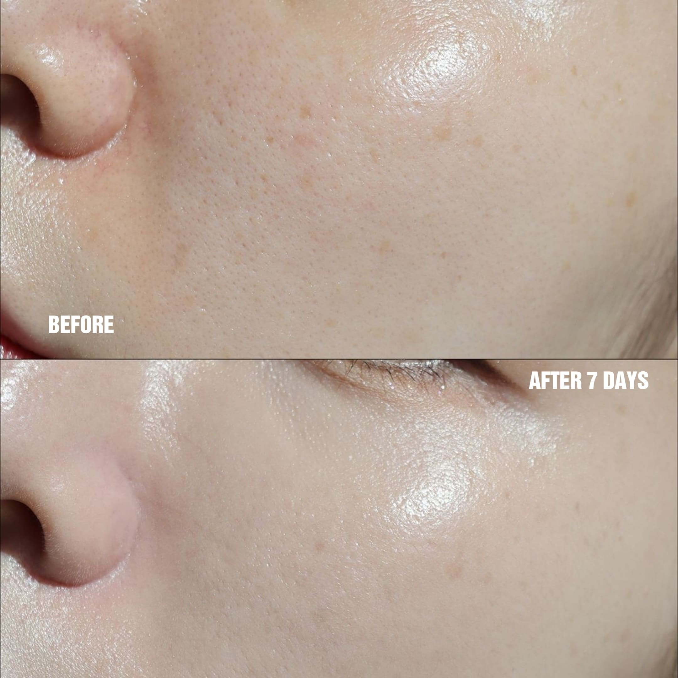 Kem Dưỡng Đêm Melagen Shot – The ILLon Melagen Shot Night Cream