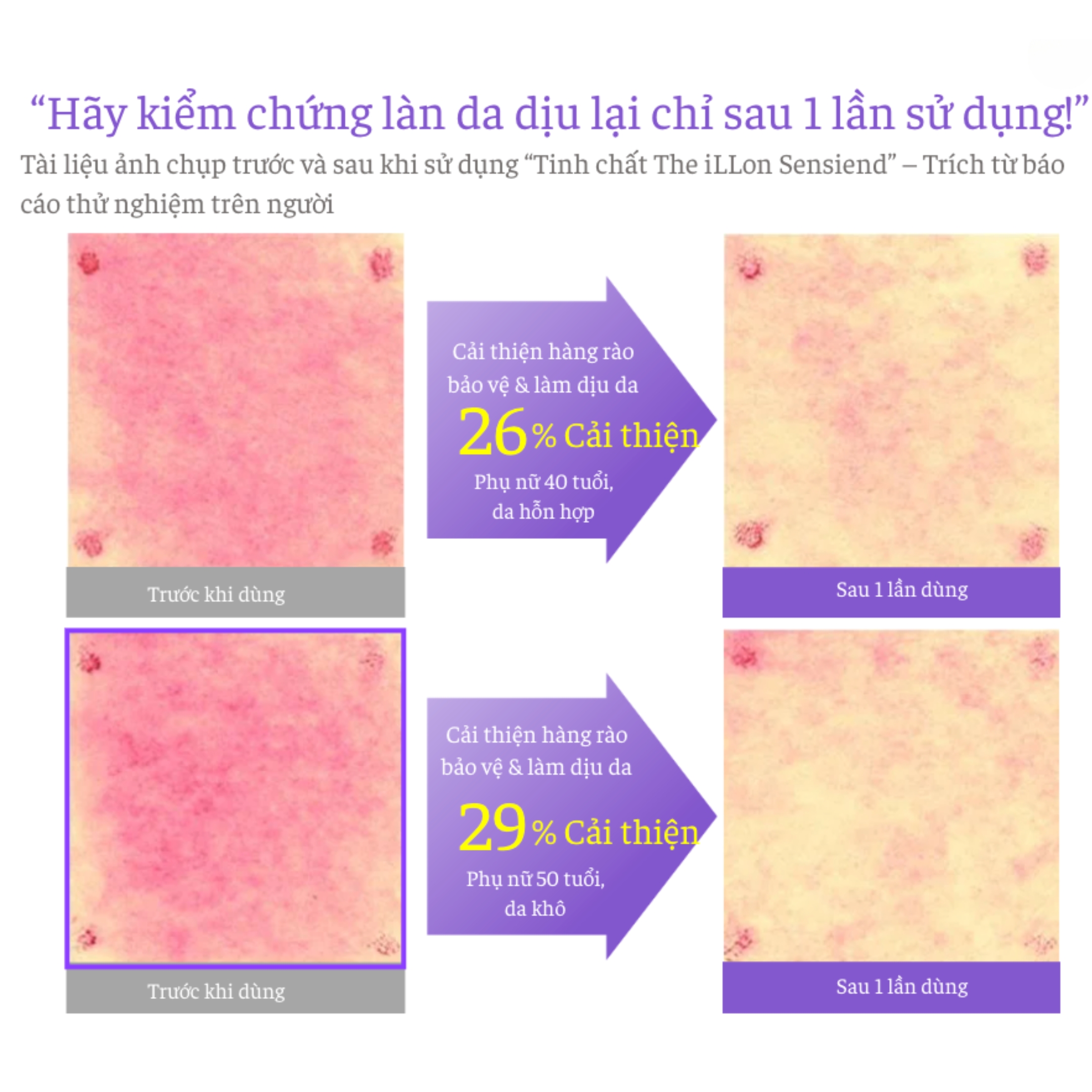 Serum Dưỡng Da – The iLLon Sensiend Ampoule
