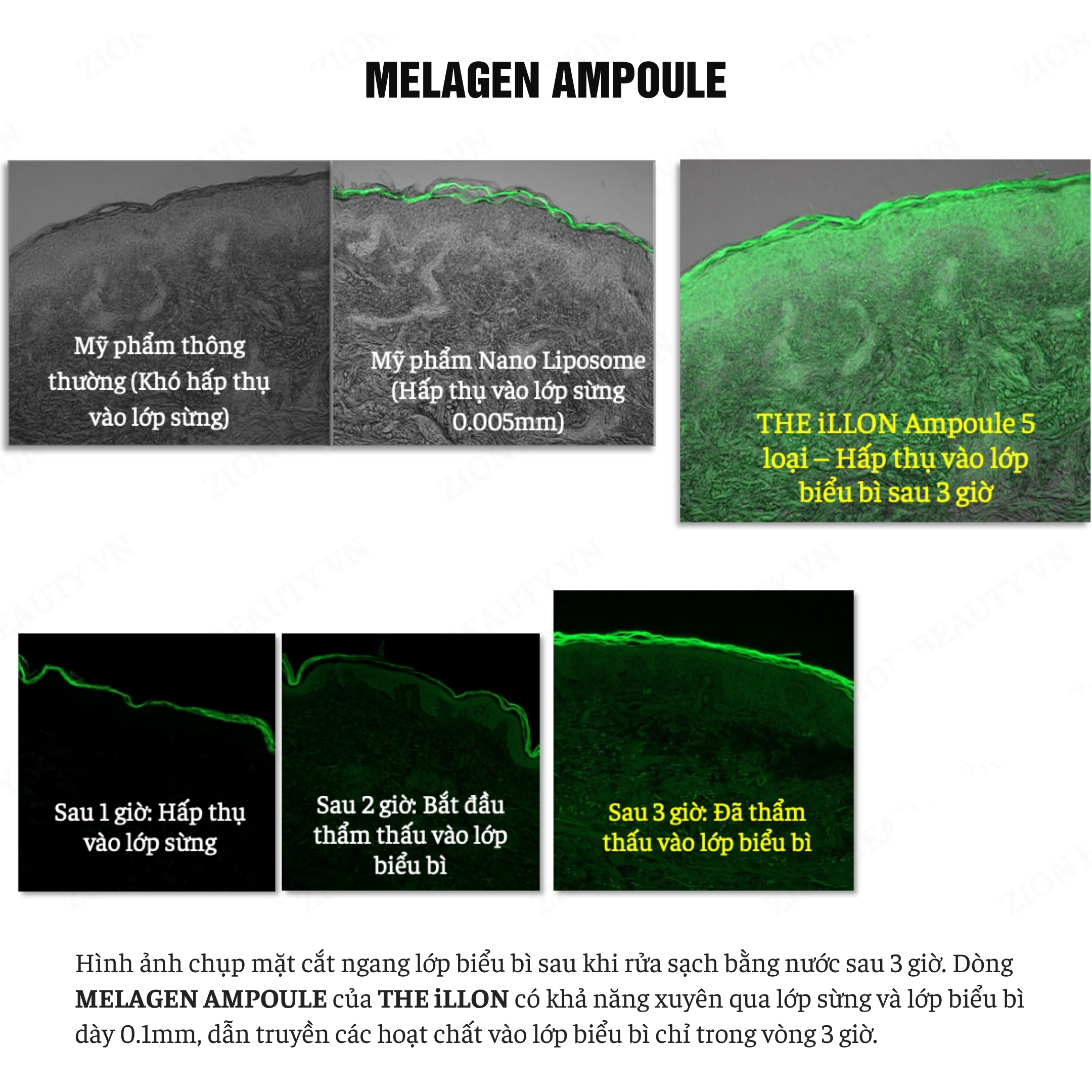Serum Dưỡng Da Cải Thiện Sắc Tố Da – The ilLon Melagen Ampoule